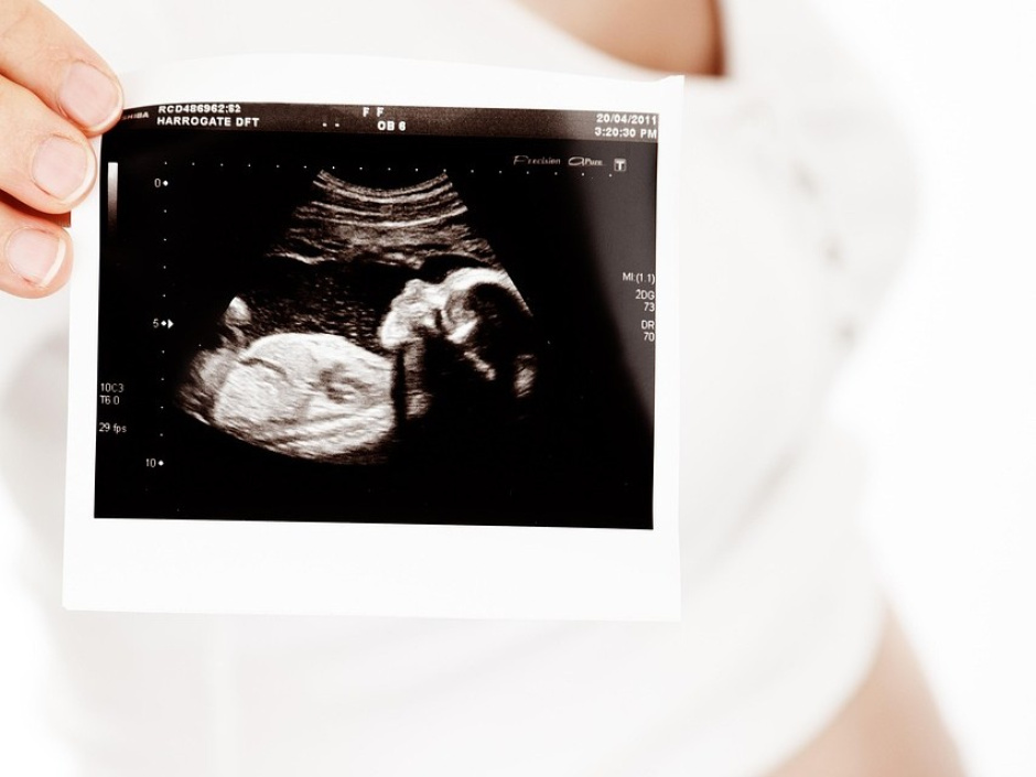 Stanowisko Zespołu Ekspertów KEP ds. Bioetycznych wobec przerywania ciąży w przypadku dziecka zdolnego do samodzielnego życia na podst. przesłanki zdrowia psychicznego